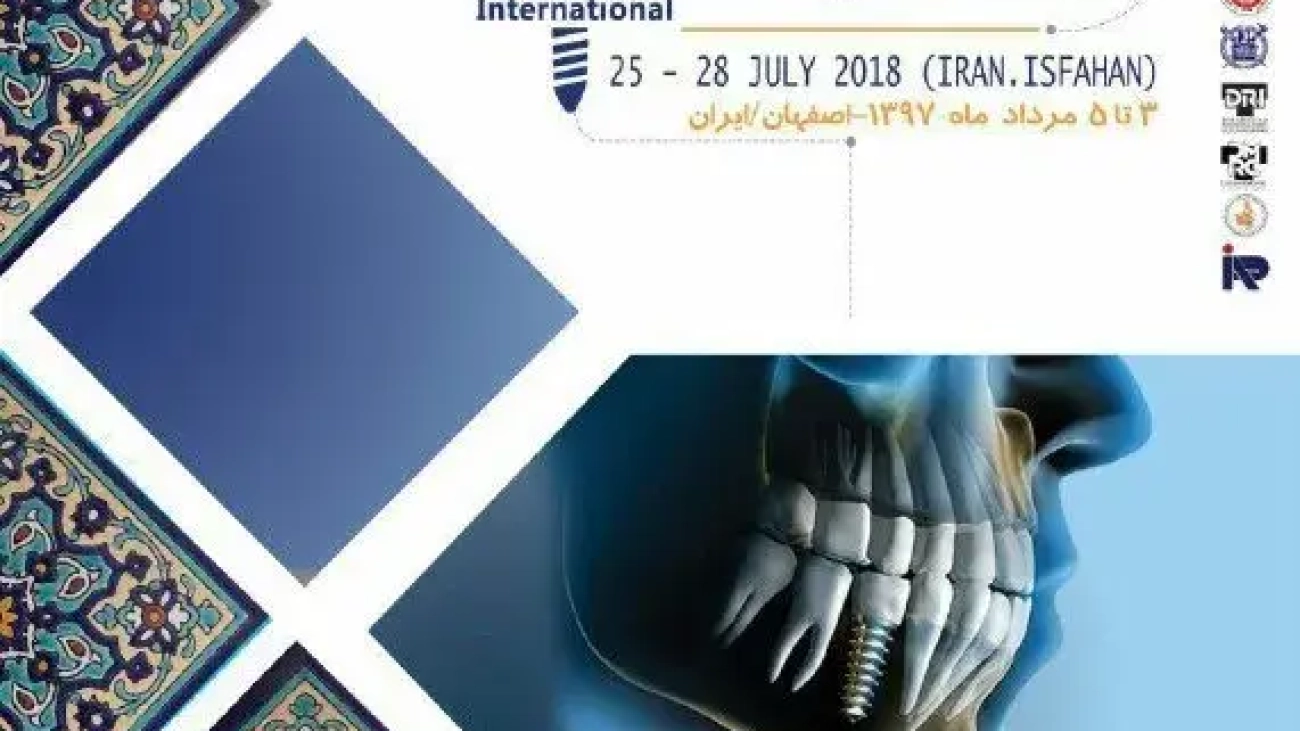 ایمپلنت